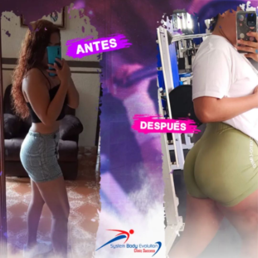 Superávit / Volumen