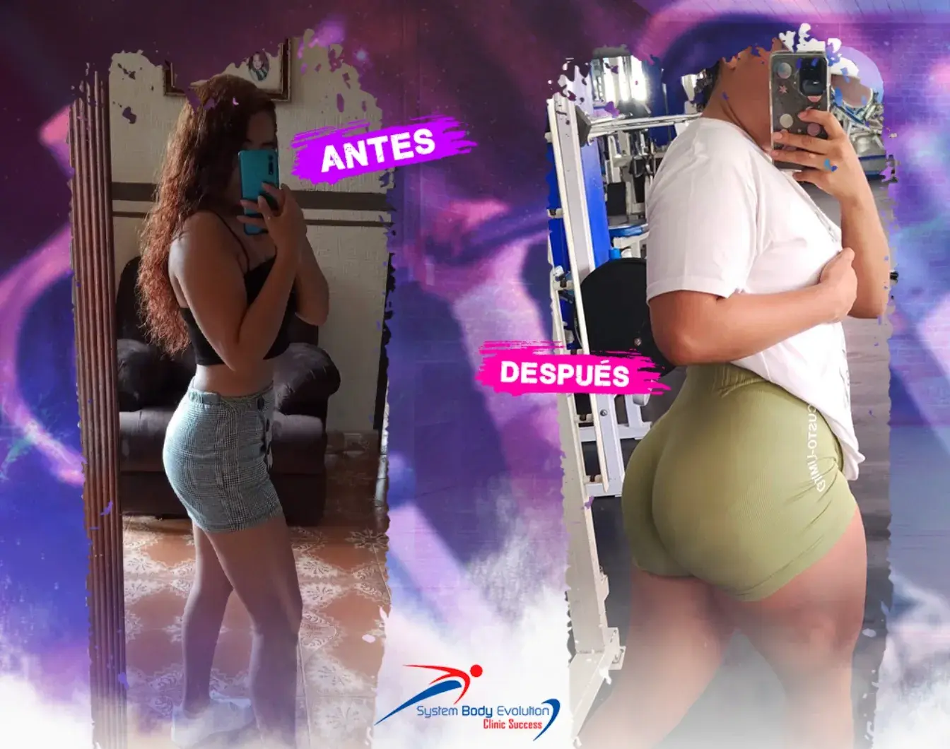 Caso real de recomposición corporal en mujer